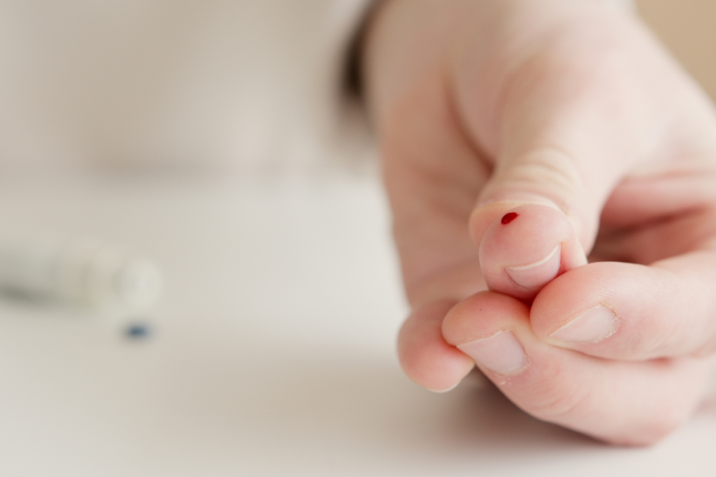 EMB blood test The Hague: orthomolecular blood test for vitamins and minerals